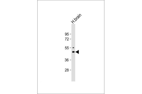 KCNJ2 antibody  (C-Term)