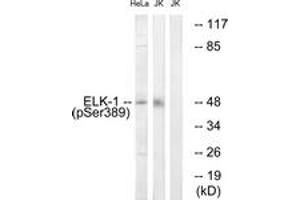 Western blot analysis of extracts from Jurkat cells treated with UV 15' and HeLa cells treated with paclitaxel 1uM 24h, using Elk1 (Phospho-Ser389) Antibody. (ELK1 antibody  (pSer389))