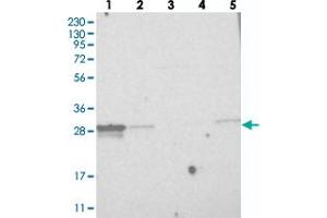 Western blot analysis of Lane 1: RT-4, Lane 2: U-251 MG, Lane 3: Human Plasma, Lane 4: Liver, Lane 5: Tonsil with MITD1 polyclonal antibody  at 1:250-1:500 dilution.