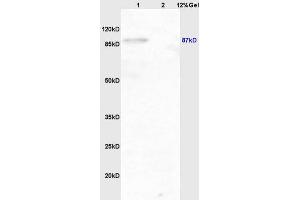 Lane 1: mouse brain lysates Lane 2: mouse lung lysates probed with Anti phospho-IKK beta(Tyr199) Polyclonal Antibody, Unconjugated (ABIN743243) at 1:200 in 4 °C.