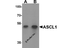 Western Blotting (WB) image for anti-Acyl-CoA Synthetase Long-Chain Family Member 1 (Acsl1) antibody (ABIN1077392) (ACSL1 antibody)