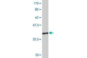 Western Blot detection against Immunogen (36. (EXOC3 antibody  (AA 646-745))