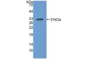 Detection of Recombinant ERK1, Human using Polyclonal Antibody to Extracellular Signal Regulated Kinase 1 (ERK1) (ERK1 antibody  (AA 75-312))