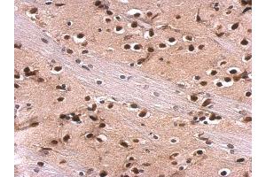 IHC-P Image MEF2A antibody [C2C3], C-term detects MEF2A protein at nucleus on rat fore brain by immunohistochemical analysis. (MEF2A antibody  (C-Term))