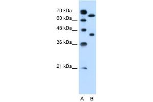 SLCO1A2 antibody used at 0. (SLCO1A2 antibody  (Middle Region))