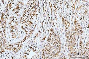 IHC analysis of IFI16 using anti-IFI16 antibody (ABIN7600374). (IFI16 antibody  (AA 183-743))