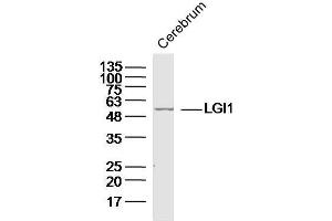 Mouse cerebrum lysates probed with LGI1 Polyclonal Antibody, unconjugated  at 1:300 overnight at 4°C followed by a conjugated secondary antibody at 1:10000 for 90 minutes at 37°C.