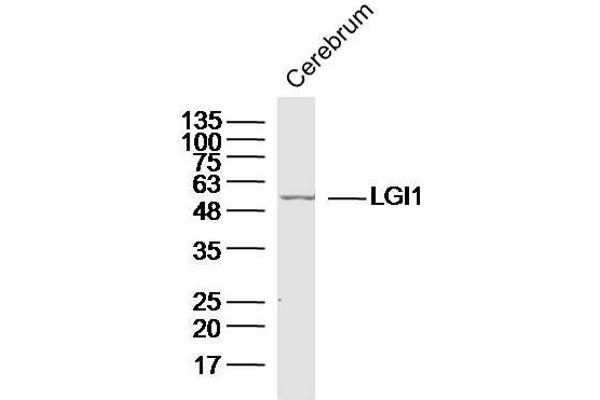 LGI1 Antikörper  (AA 451-557)