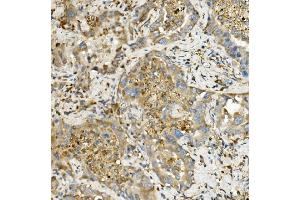 IHC analysis of Hexokinase 1/HK1 using anti-Hexokinase 1/HK1 antibody (ABIN7600258).