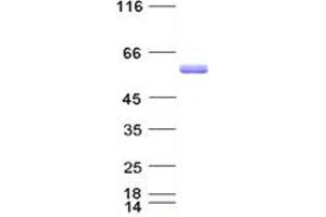 Validation with Western Blot (NCOA1 Protein (His tag))