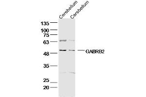 Western Blotting (WB) image for anti-gamma-aminobutyric Acid (GABA) A Receptor, beta 2 (GABRB2) (AA 251-350) antibody (ABIN1387703)