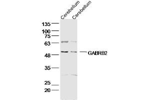 Lane 1: Rat Cerebellum lysates; Lane 2: Mouse Cerebellum lysates; probed with GABRB2/GABA A Receptor beta 2 Polyclonal Antibody, unconjugated (bs-12065R) at 1:300 overnight at 4°C followed by a conjugated secondary antibody for 60 minutes at 37°C. (GABRB2 antibody  (AA 251-350))