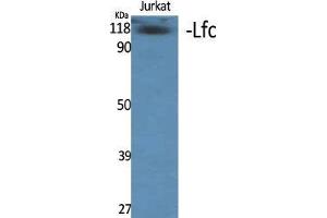 Western Blot (WB) analysis of specific cells using Lfc Polyclonal Antibody. (ARHGEF2 antibody  (Tyr427))