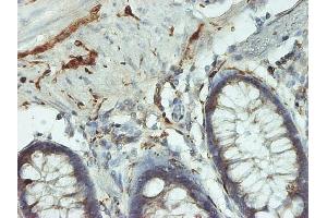 Immunoperoxidase of monoclonal antibody to UCHL1 on formalin-fixed paraffin-embedded human colon. (UCHL1 antibody  (AA 1-223))