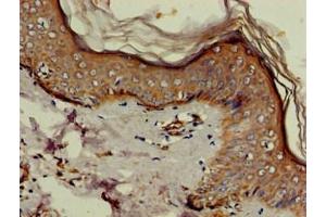 Immunohistochemistry of paraffin-embedded human skin tissue using ABIN7152180 at dilution of 1:100 (EIF4B antibody  (AA 362-590))