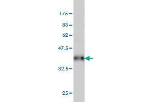 Western Blot detection against Immunogen (38. (ZAK antibody  (AA 1-120))