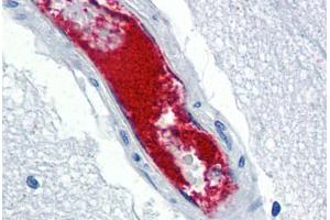 Human Brain, Cortex, Vessel (formalin-fixed, paraffin-embedded) stained with VWF antibody ABIN337312 at 5 ug/ml followed by biotinylated anti-goat IgG secondary antibody ABIN481715, alkaline phosphatase-streptavidin and chromogen. (VWF antibody)