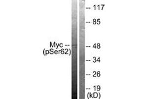 Western blot analysis of extracts from 293 cells treated with Forskolin 40nM 30', using Myc (Phospho-Ser62) Antibody. (c-MYC antibody  (pSer62))