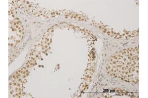 Immunoperoxidase of monoclonal antibody to NUDT21 on formalin-fixed paraffin-embedded human testis. (NUDT21 antibody  (AA 1-227))