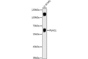 Western blot analysis of extracts of U-87MG cells, using PL antibody (ABIN7269418) at 1:1000 dilution. (PLAG1 antibody  (AA 33-288))