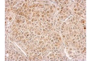 IHC-P Image CIAPIN1 antibody detects CIAPIN1 protein at cytosol on by immunohistochemical analysis. (CIAPIN1 antibody)