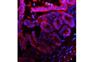 IF analysis of EpCAM using anti-EpCAM antibody (ABIN7600081).