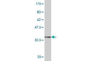 Western Blot detection against Immunogen (33. (LHX5 antibody  (AA 114-182))