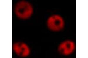 ABIN6267010 staining HepG2 by IF/ICC. (ZNF148 antibody  (N-Term))