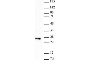 Histone H2B ubiquityl Lys120 antibody tested by Western blot. (Histone H2B antibody  (Lys120, ubLys120))
