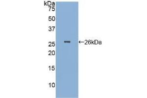 Detection of Recombinant PGA, Human using Polyclonal Antibody to Pepsinogen A (PGA) (Pepsinogen A antibody  (AA 63-295))