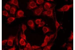 ABIN6273874 staining 293T by IF/ICC. (GPR4 antibody  (Internal Region))