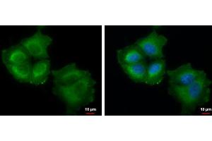 ICC/IF Image Thymidylate synthetase antibody detects Thymidylate synthetase protein at cytoplasm by immunofluorescent analysis.
