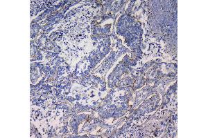 IHC analysis of Integrin alpha 5 using anti-Integrin alpha 5 antibody . (ITGA5 antibody  (AA 42-263))