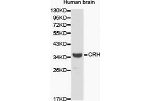 Western Blotting (WB) image for anti-Corticotropin Releasing Hormone (CRH) antibody (ABIN1872000) (CRH antibody)