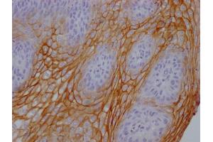 IHC image of ABIN7180656 diluted at 1:100 and staining in paraffin-embedded human tonsil tissue performed on a Leica BondTM system. (CEACAM5 antibody)