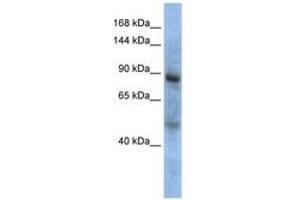 Image no. 1 for anti-Zinc Fingers and Homeoboxes 3 (ZHX3) (AA 648-697) antibody (ABIN6744227)