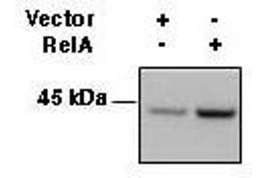 HLA-ABC Antikörper