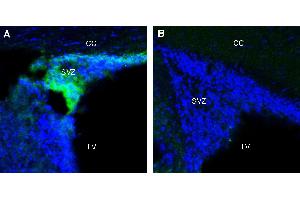 Expression of Adenosine A1 Receptor in rat subventricular zone (SVZ).