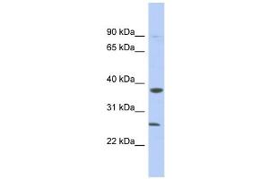 MYD88 antibody used at 1 ug/ml to detect target protein.