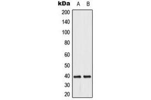 Western blot analysis of DUSP1/4 expression in HeLa (A), Jurkat (B) whole cell lysates. (MKP-1/2 antibody  (C-Term))