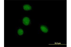 Immunofluorescence of purified MaxPab antibody to ZBTB6 on HeLa cell. (ZBTB6 antibody  (AA 1-424))