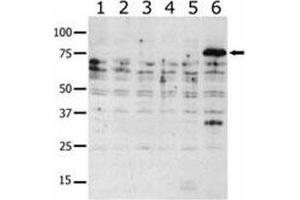 Western blot analysis of PAK6 antibody in lysate from transiently transfected COS7 cells.