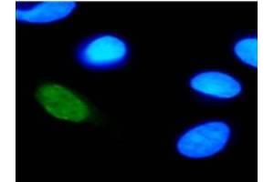 IF was carried out with U2OS cells transfected with plasmid expressing HPV-11 E2 protein. (Human Papilloma Virus 11 E2 (HPV-11 E2) (AA 202-284) antibody)