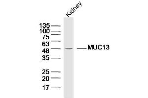 Lane 1: Mouse kidney lysates probed with Anti MUC13 Polyclonal Antibody, Unconjugated  at 1:300 overnight at 4˚C.