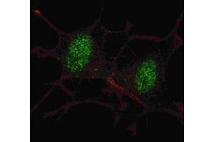 Fluorescent confocal image of SY5Y cells stained with SMAD2 antibody at 1:100. (SMAD2 antibody  (AA 97-125))