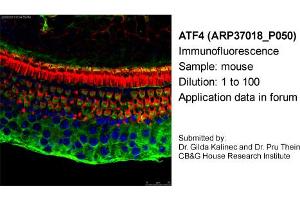 Image no. 1 for anti-Activating Transcription Factor 4 (Tax-Responsive Enhancer Element B67) (ATF4) antibody (ABIN2779919) (ATF4 antibody)