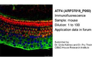 Image no. 1 for anti-Activating Transcription Factor 4 (Tax-Responsive Enhancer Element B67) (ATF4) antibody (ABIN2779919) (ATF4 antibody)