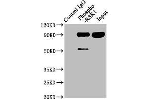 Immunoprecipitating Phospho-RPS6KA1 in Hela whole cell lysate Lane 1: Rabbit control IgG(1 μg)instead of ABIN7127743 in Hela whole cell lysate. (Recombinant RPS6KA1 antibody  (pSer380))