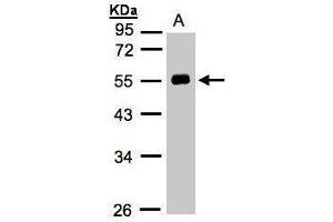 Western blot analysis of 30 ug whole cell lysate (A:Hep G2) using a 10 % SDS PAGE gel and Angiotensinogen antibody at a dilution of 1:1000