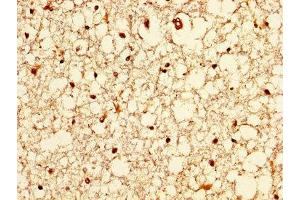 IHC image of ABIN7176635 diluted at 1:200 and staining in paraffin-embedded human brain tissue performed on a Leica BondTM system. (ZIC4 antibody  (AA 28-88))